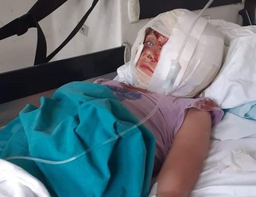 STRAŠNO! Pas unakazio dete u Raniloviću kod Aranđelovca