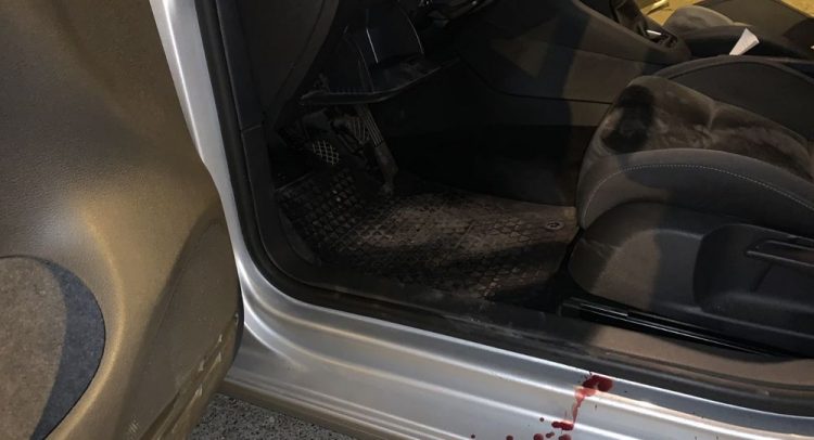 Za napad sekirom tužilaštvo u Kragujevcu kaže da nije pokušaj ubistva! (uznemirujuće)