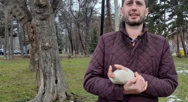 Nikola je zbog petarde ostao bez prstiju- „Bukvalno mi je raznela šaku!“ (uznemirujući foto!!!)