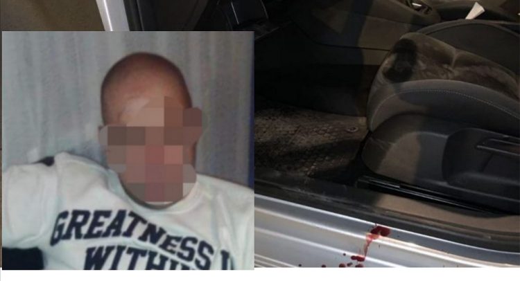 Ranjeni Ivica P (33) iz Aranđelovca napao čoveka sekirom