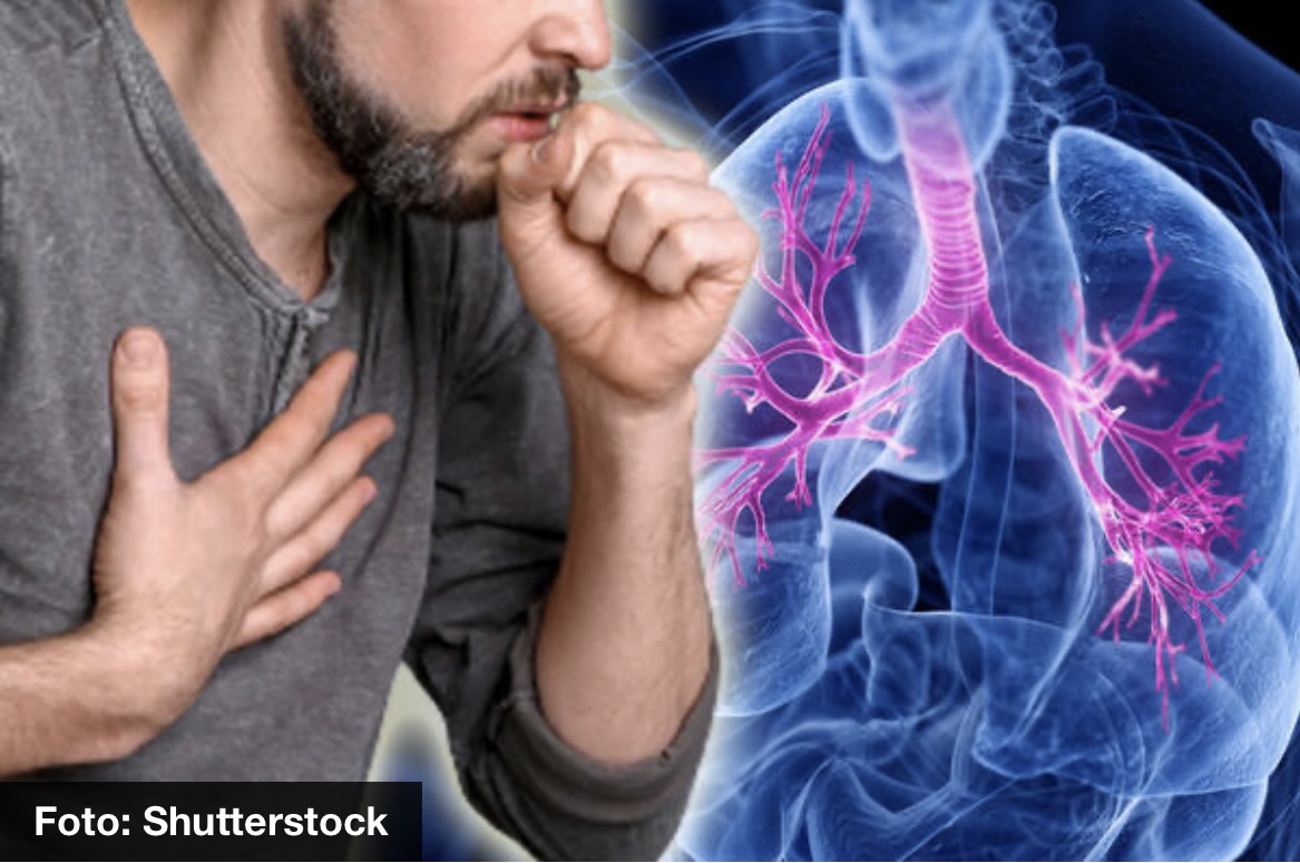 „JEDNA OSOBA MOŽE DA OBOLI VIŠE PUTA“ Srpska doktorka o povratku velikog kašlja: Evo na šta posebno treba da OBRATITE PAŽNJU