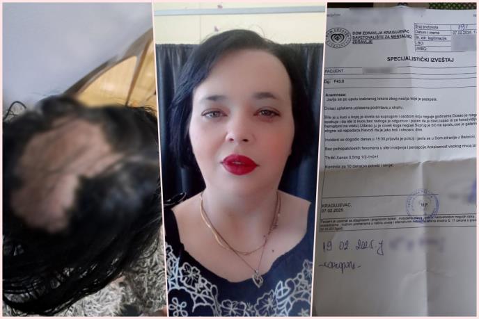 NEGOVATELJICA IZ BATOČINE TVRDI: Čovek koga sam čuvala i hranila 15 godina me pretukao sa svojim bratom, iščupano mi je pola kose!