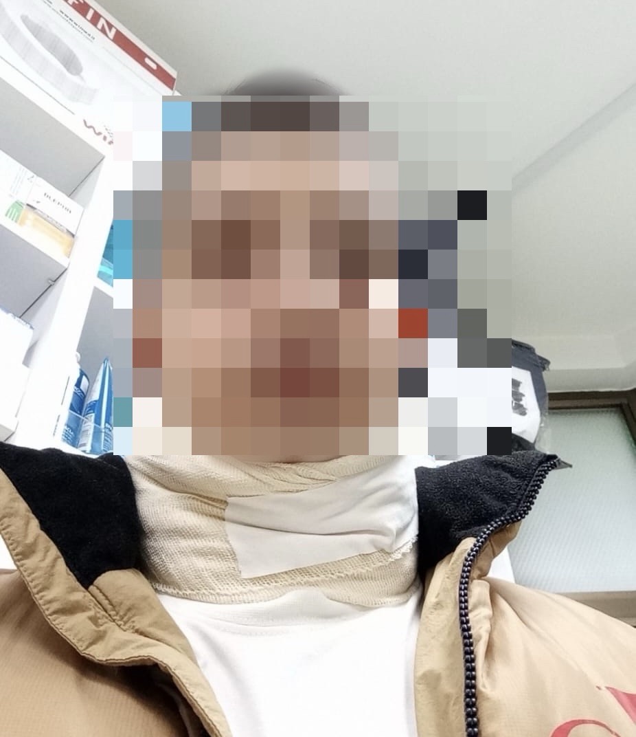 TROJICA NA JEDNOG: Pretučen mladić kod Rače – tvrdi da su među napadačima policijski službenici, pet meseci bez epiloga